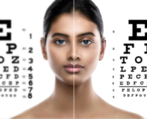 Vision before and vision after LASIK eye surgery at BDPL Scottsdale